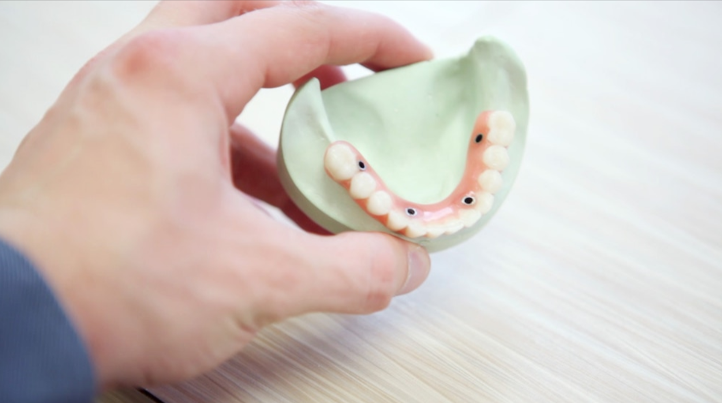 Top Tooth Replacement Options